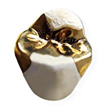 ゴールドインレー